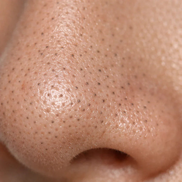 Sebaceous Filaments, Explained: What They Are (and Why They're Not Blackheads)