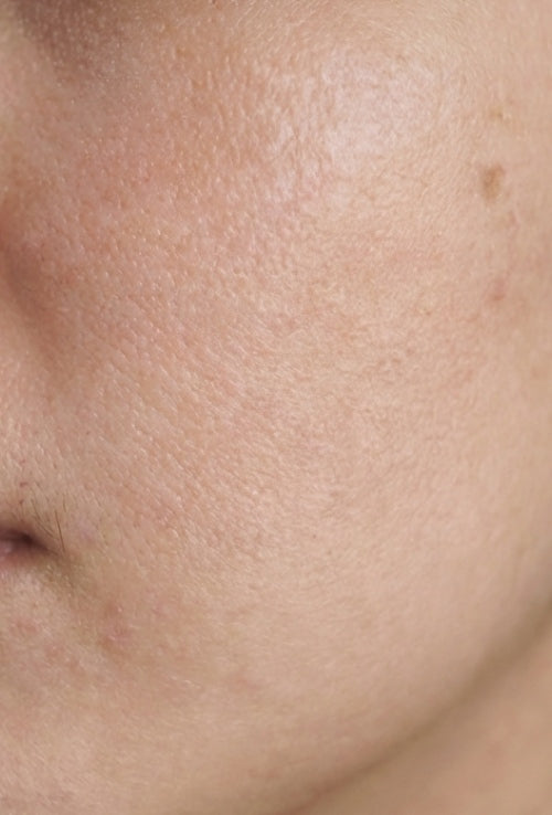 After — CellMorph™ 500 Spicule Serum