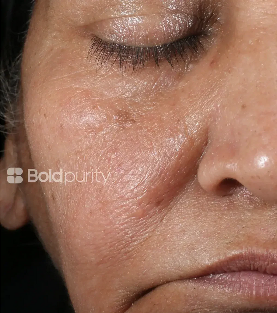 Boldpurity SkinReset™ Review — 8-Week Hydration Results