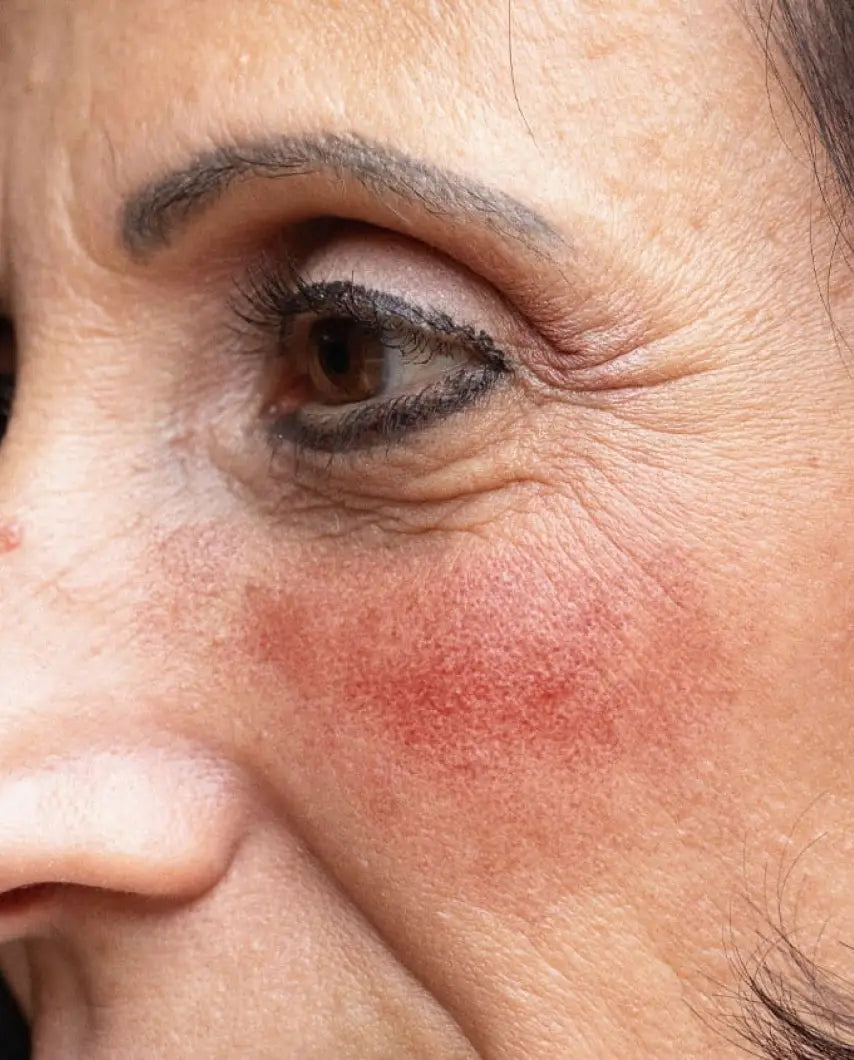 LIVING WITH VISIBLE FACIAL REDNESS | REGULATORY & SAFETY AUDIT