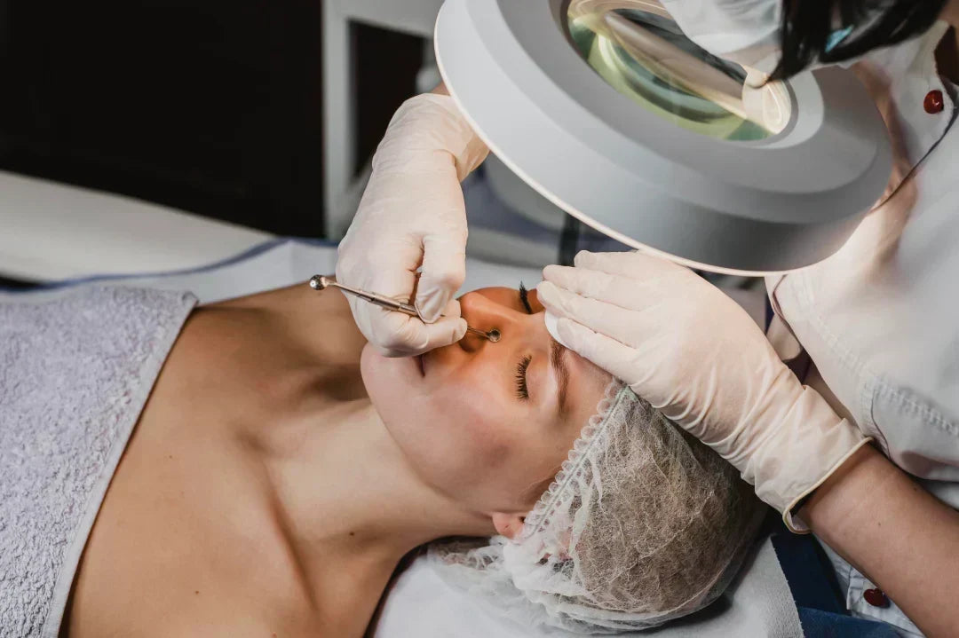 Hydro-Dermabrasion Facials, Explained: Do They Help Blackheads? 