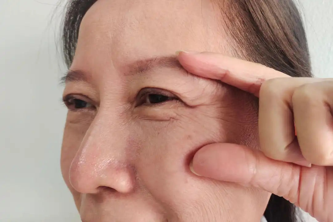 Collagen degradation pathway during skin inflammation