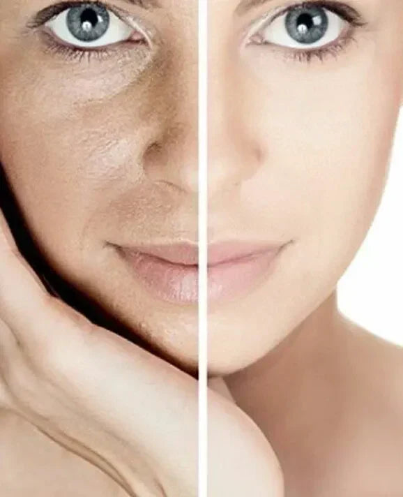 Dull vs Dehydrated Skin: How to Tell the Difference – ingredient hero