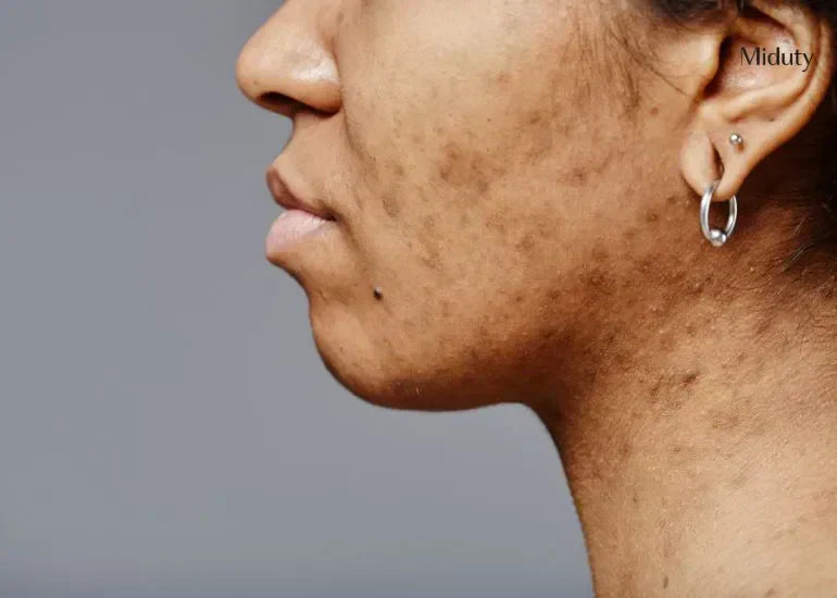 Hormones & Skin Appearance: How Your Body's Chemistry Affects Your Complexion – ingredient hero