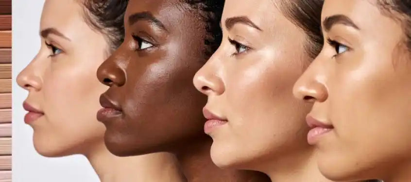 Fitzpatrick skin phototype scale I to VI showing differences in sun response and pigmentation