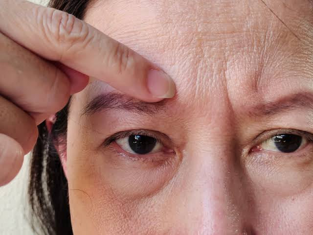 Does Lack of Sleep Really Dull Your Skin? 