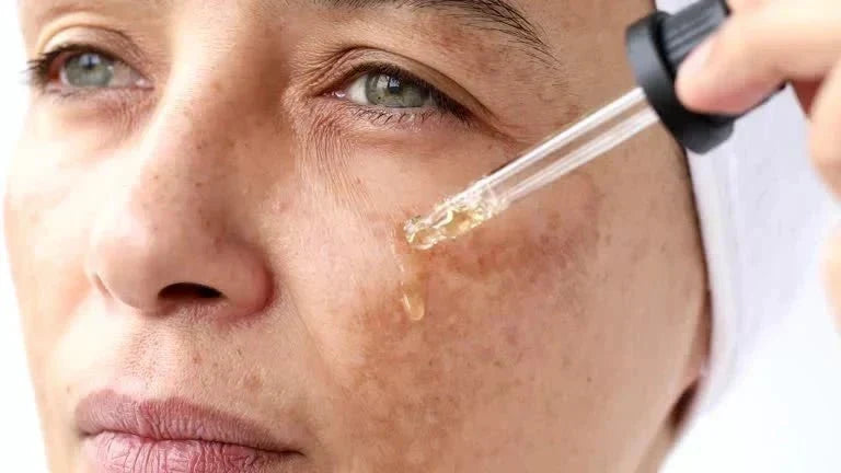 Melasma on the Face in Indian Skin: What Is Melasma, Its Causes, What Research Says About Treatment - Boldpurity Skincare
