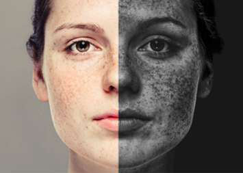 Pollution and Dull Skin: How City Air Affects Your Radiance 