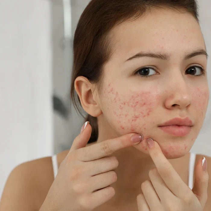 Skin Congestion Explained — Causes, Ingredients & Routine