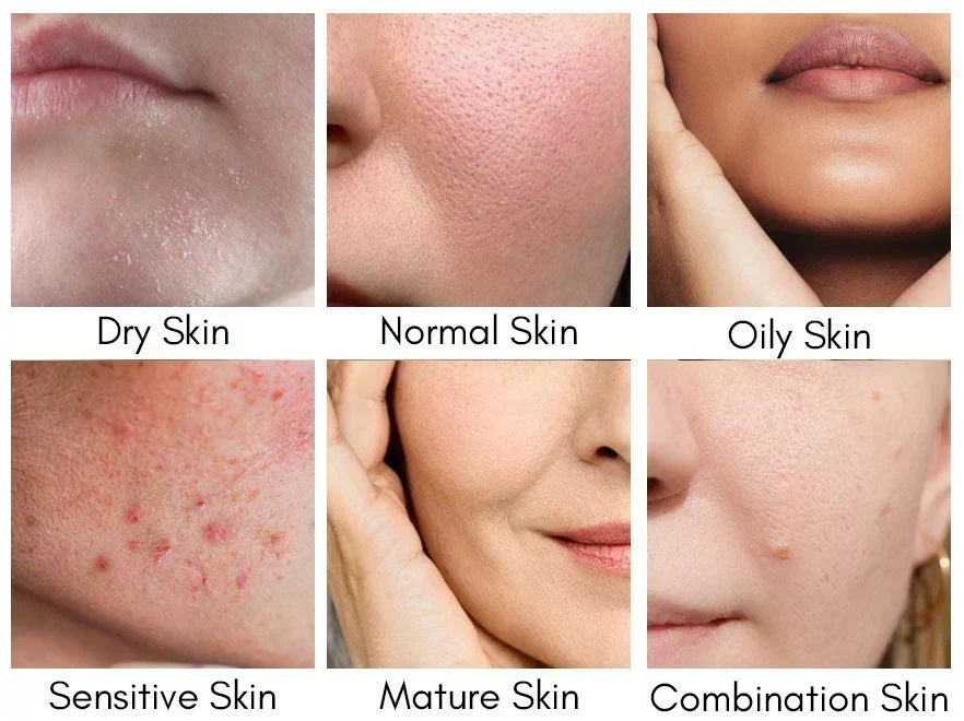 How to Determine Your Skin Type at Home