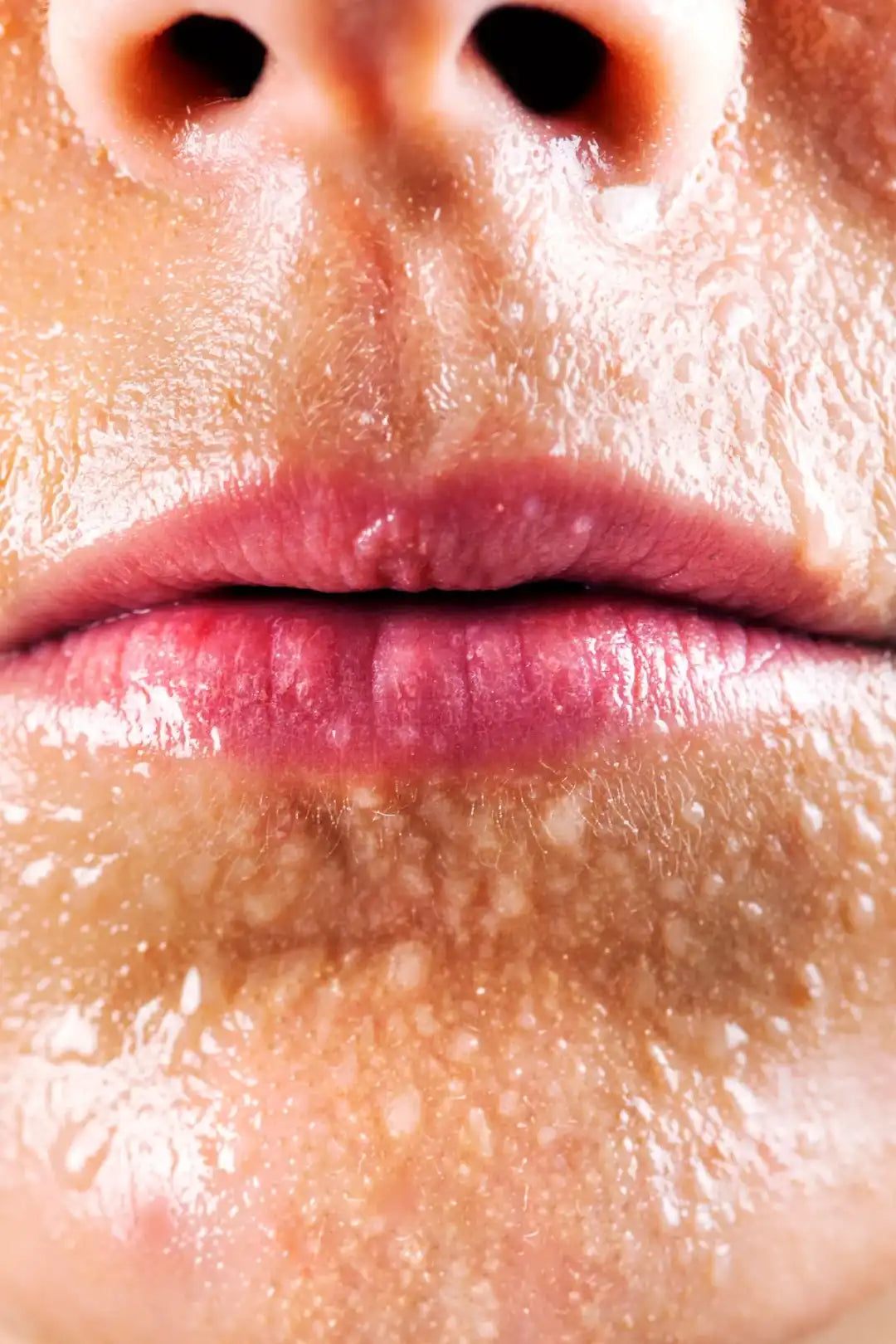 Sweat, Humidity & Tropical Climate Effects on Skin | Boldpurity