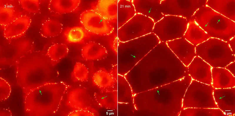 Scientific illustration of tight junctions connecting epidermal cells and regulating skin barrier permeability