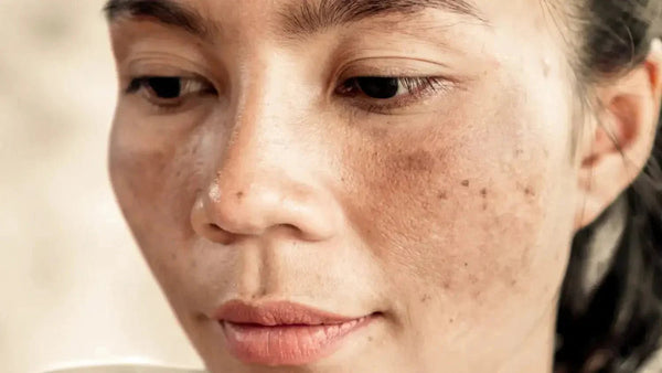 Undecylenoyl Phenylalanine (Sepiwhite): The Brightening Ingredient That Stops Dark Spots Before They Start