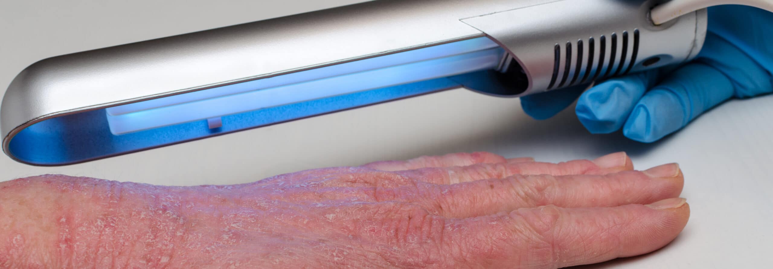 A clinical narrowband UVB phototherapy unit used to treat psoriasis"