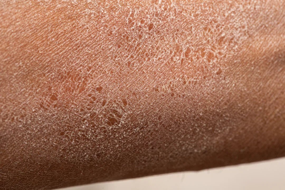 Why Is Your Skin Drier on an Airplane? The Science & the Fix - Boldpurity Skincare