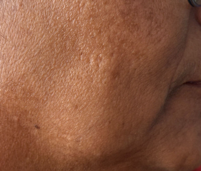 After - Aquablur Bubble Toner Serum