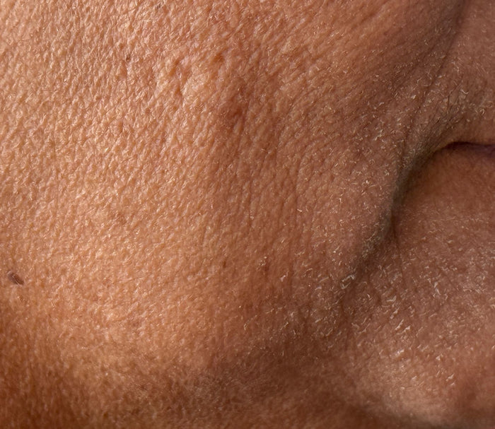 Before - Aquablur Bubble Toner Serum