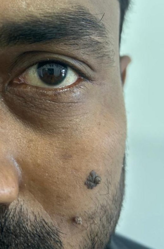 Before - Skinreset™ PDRN Serum