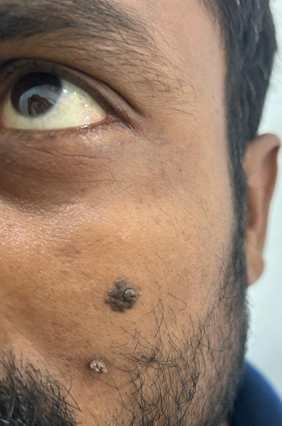 After - Skinreset™ PDRN Serum