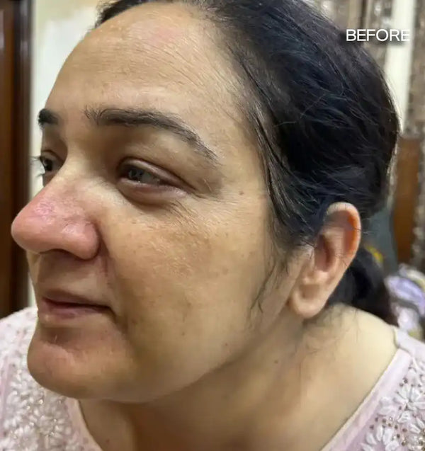 before using skinreset pdrn serum